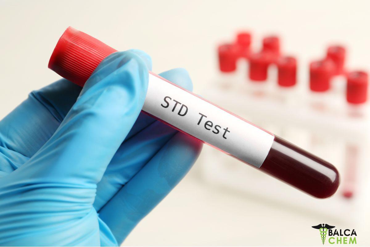 A Practical Guide to Free STD Testing